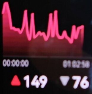 Huawei Band 10 chart Huawei Band 10 bpm chart
